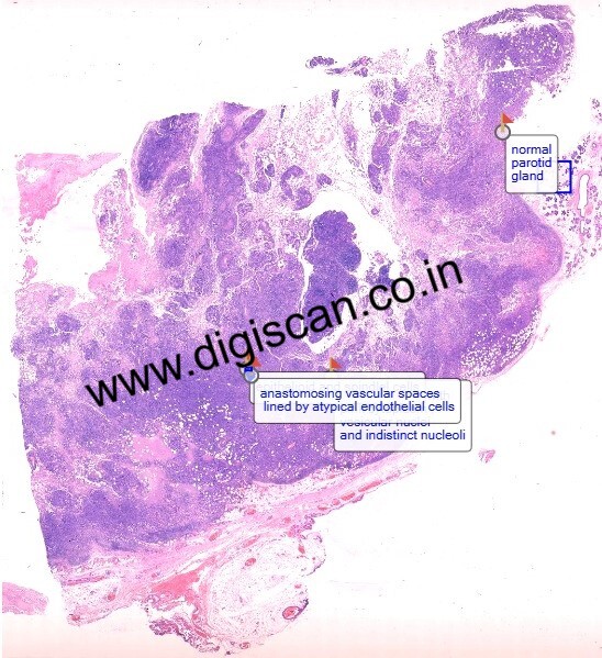 MDS Oral Pathology Exam Cases (Digital Slides & Spot Diagnosis)